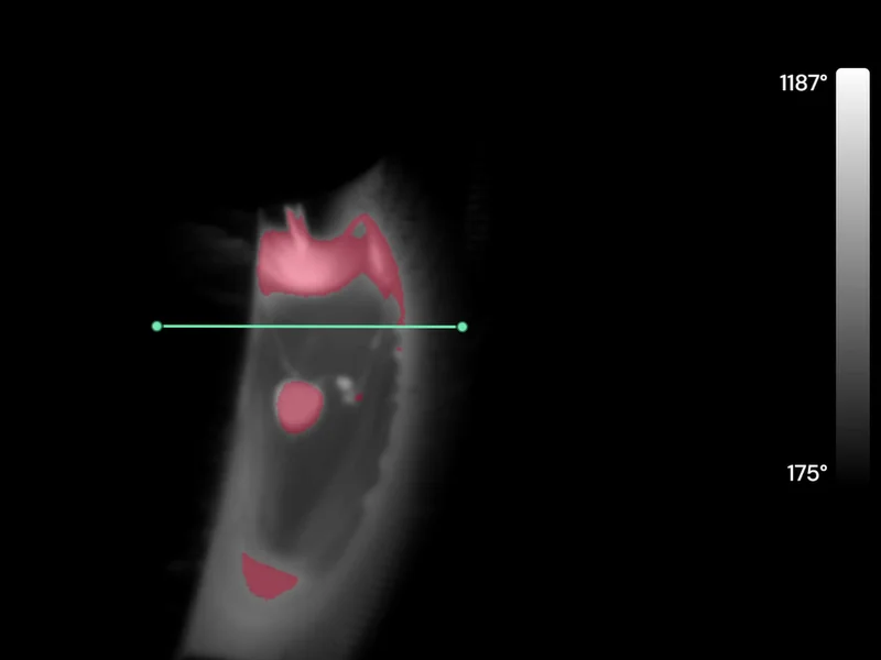 HeatCore AI live thermal view: weld pool segmented in red, a measurement line across the pool and the temperature scale
